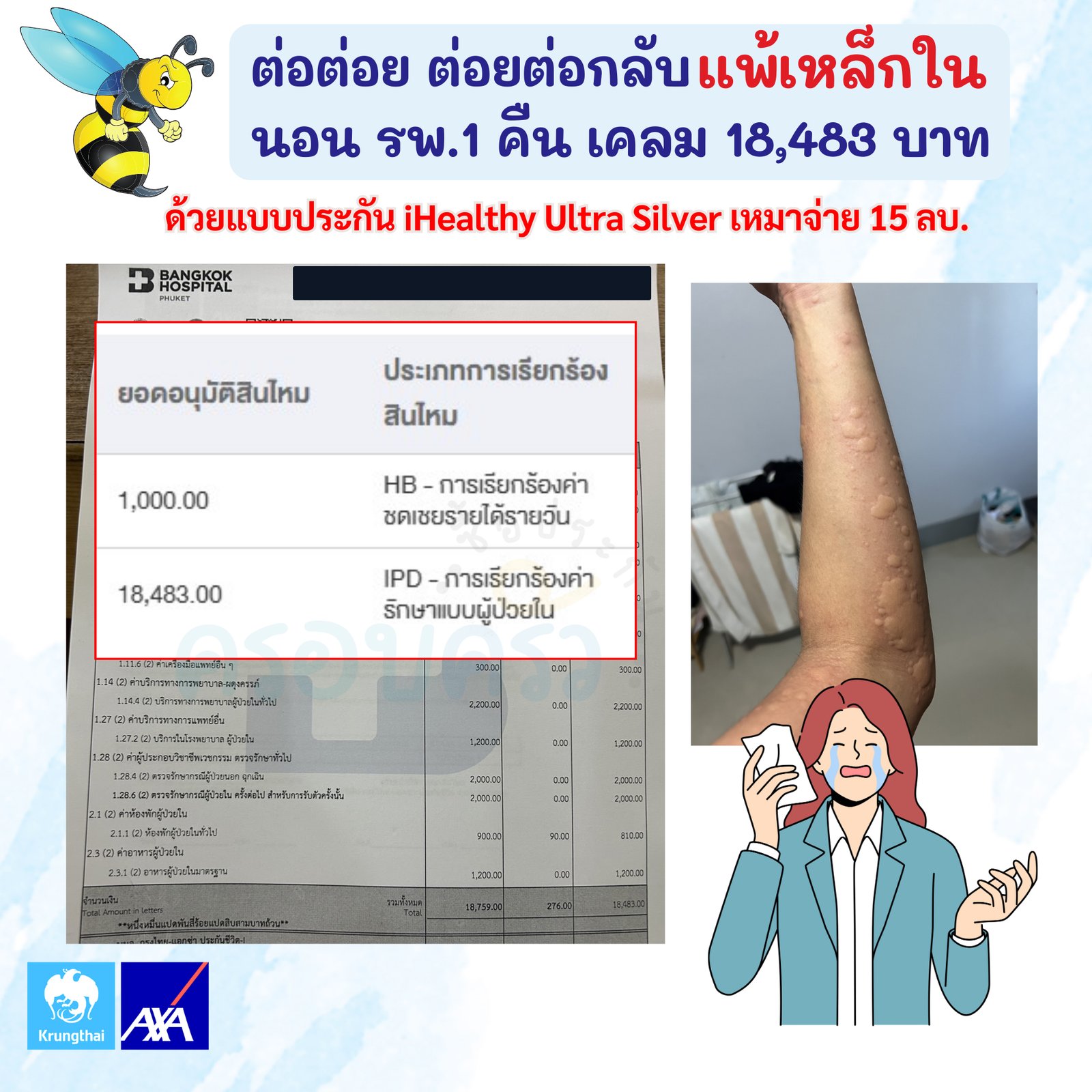 รูปรีวิวเคลม แพ้พิษเหล็กในจากแมลงต่อย ต้องนอนโรงพยาบาล 1 คืน (ปิดชื่อลูกค้าแล้ว)