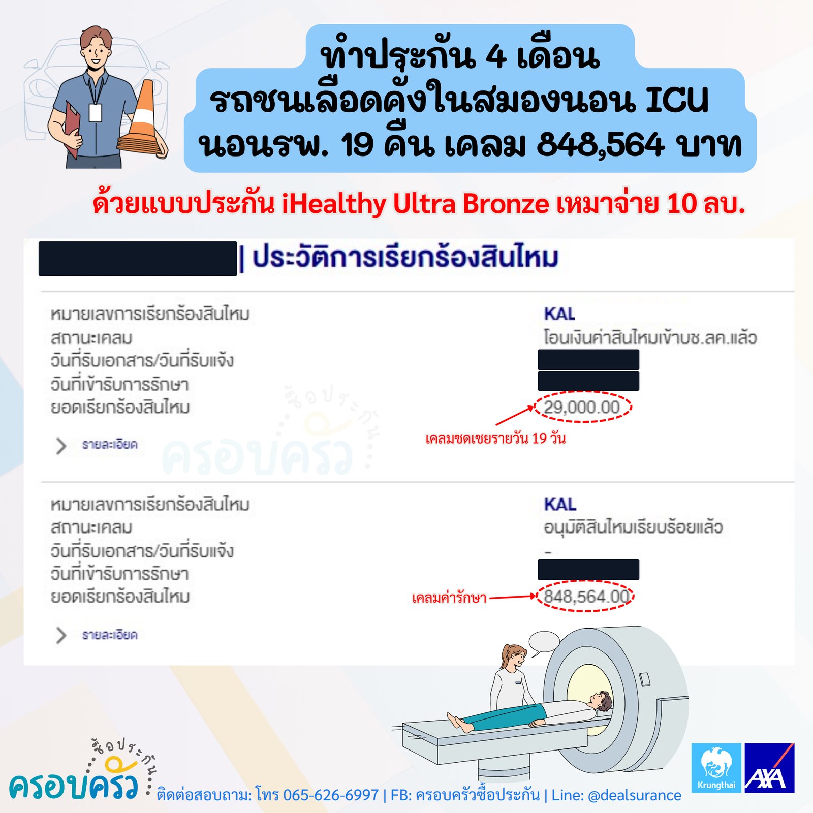 รูปรีวิวเคลม อุบัติเหตุรถชน เลือดคั่งในสมอง นอน ICU และนอนโรงพยาบาลรวม 19 คืน (ปิดชื่อลูกค้าแล้ว)