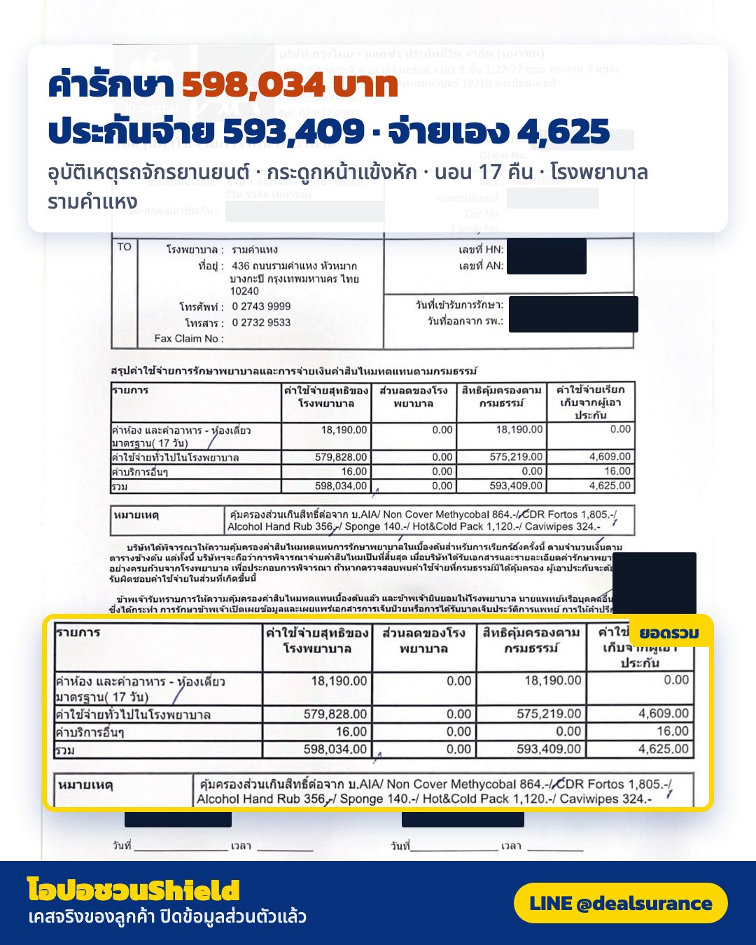 รูปรีวิวเคลม กระดูกหน้าแข้งส่วนบนหักจากอุบัติเหตุรถจักรยานยนต์ (ปิดชื่อลูกค้าแล้ว)