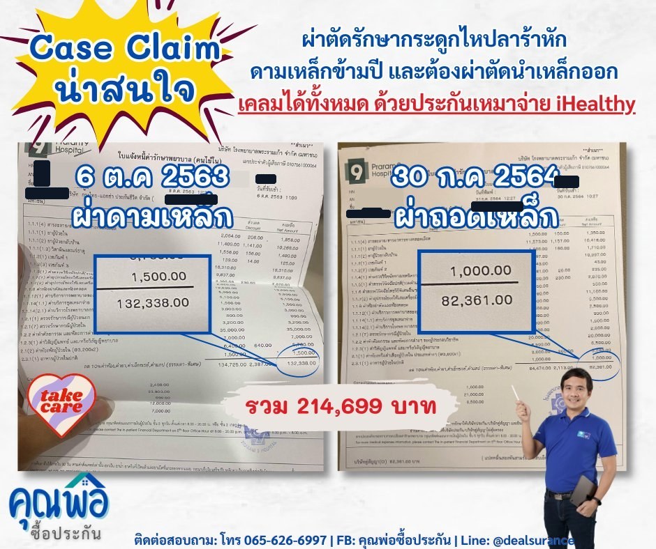 การ์ดสรุป — ผ่าตัดดามเหล็ก 132,338 + ผ่าตัดถอดเหล็ก 82,361 รวม 214,699 บาท
