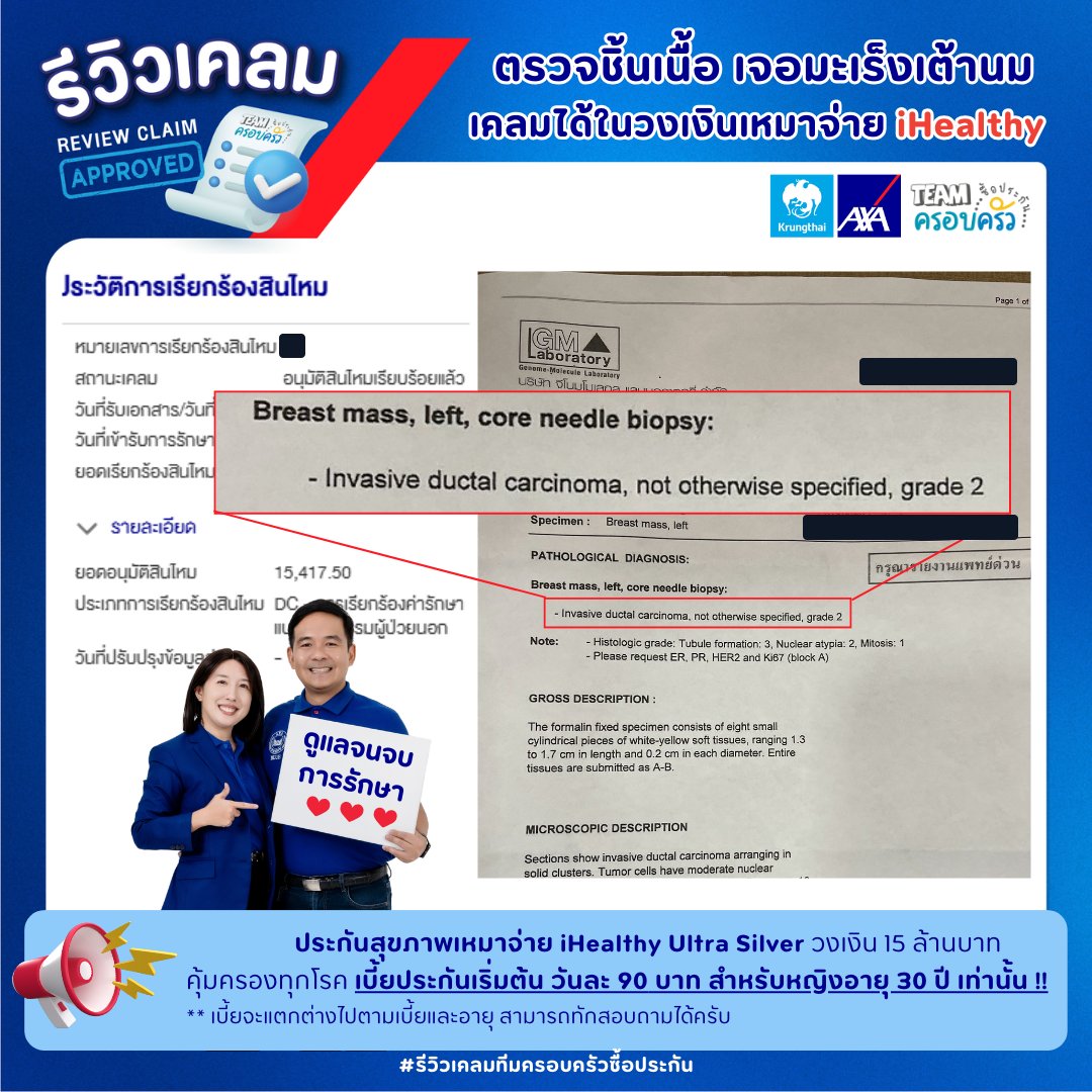รูปรีวิวเคลม ตัดชิ้นเนื้อก้อนที่เต้านมส่งตรวจ ผลออกมาเป็นมะเร็งเต้านมชนิด invasive ductal carcinoma เกรด 2 (ปิดชื่อลูกค้าแล้ว)