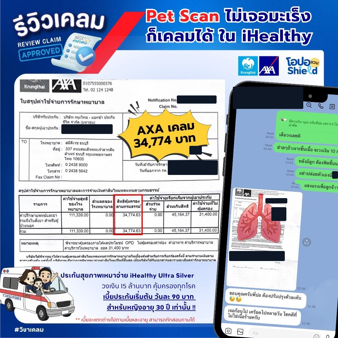 รูปรีวิวเคลม ตรวจพบก้อน ส่งตรวจ PET scan เพื่อหามะเร็ง ผลไม่พบมะเร็ง (ไม่ใช่เนื้อร้าย) (ปิดชื่อลูกค้าแล้ว)