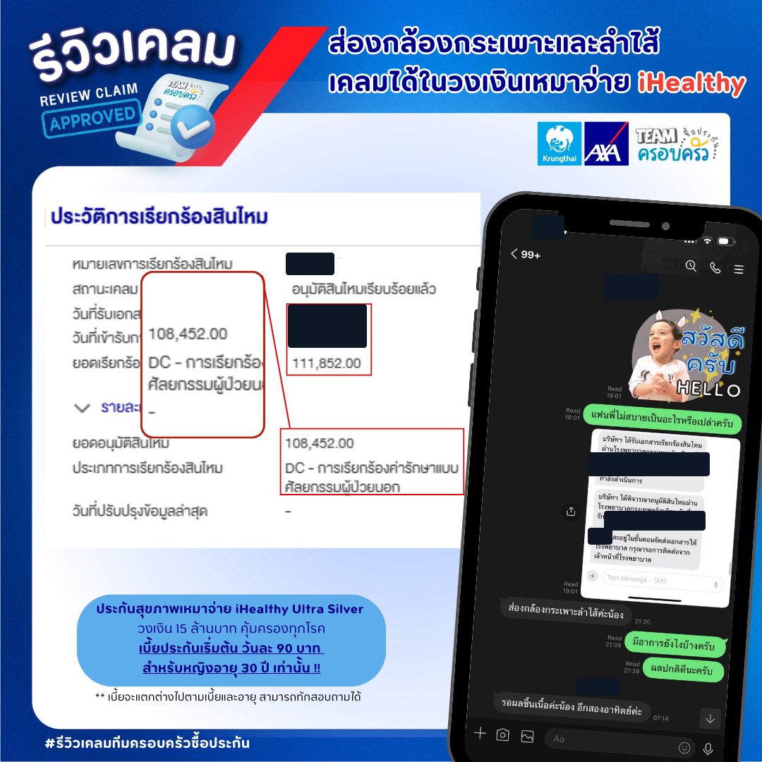 รูปรีวิวเคลม ส่องกล้องกระเพาะอาหารและลำไส้ แบบศัลยกรรมผู้ป่วยนอก และตัดชิ้นเนื้อส่งตรวจ (ปิดชื่อลูกค้าแล้ว)