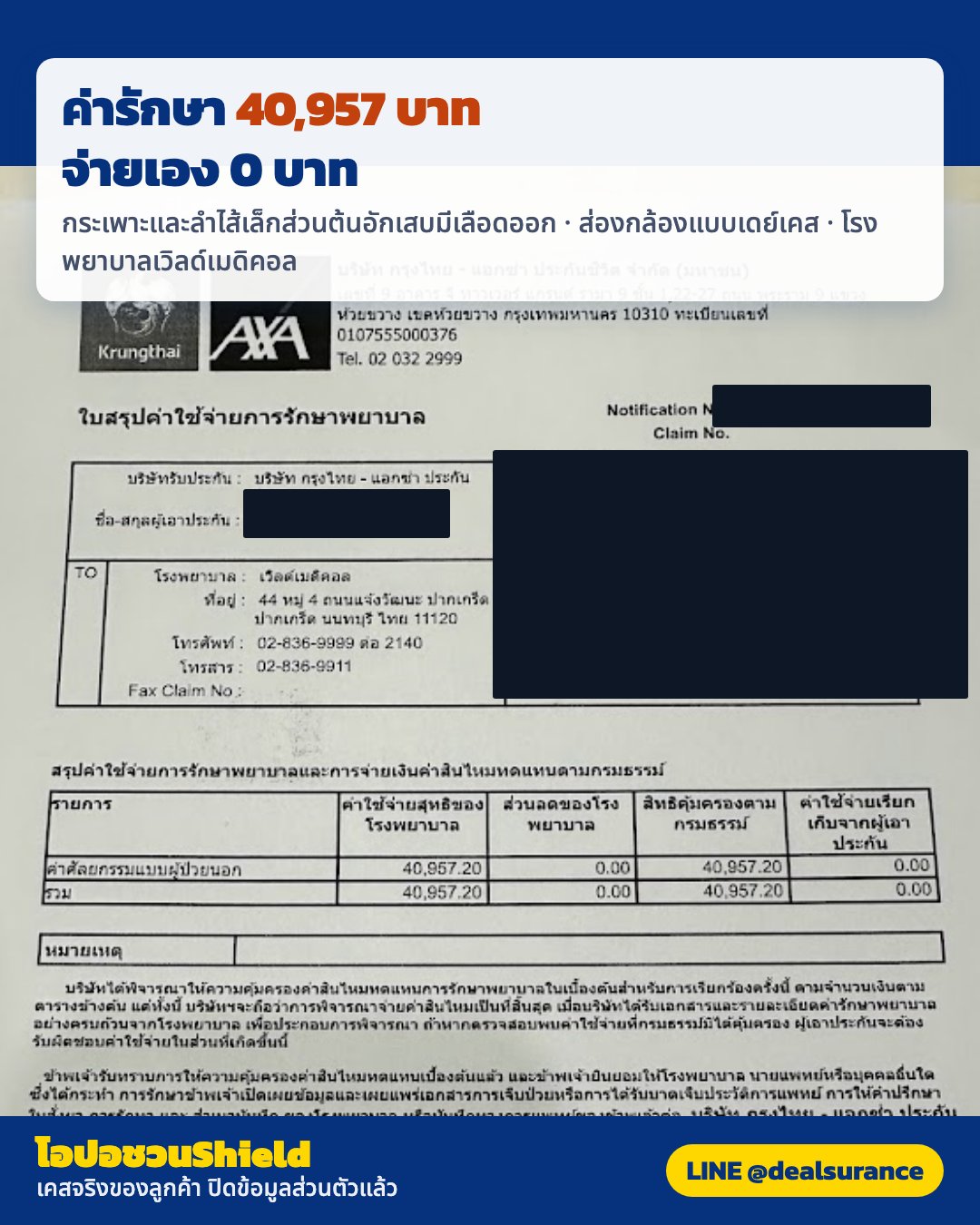 รูปรีวิวเคลม กระเพาะอาหารและลำไส้เล็กส่วนต้นอักเสบมีเลือดออก (hemorrhagic gastroduodenitis) ตรวจพบจากการส่องกล้องเพราะปวดท้อง (ปิดชื่อลูกค้าแล้ว)