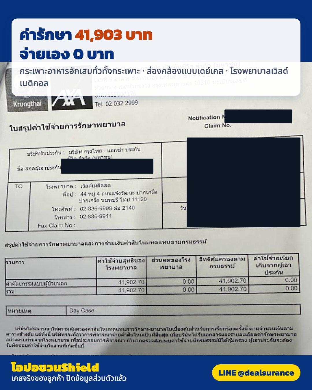 รูปรีวิวเคลม กระเพาะอาหารอักเสบทั่วทั้งกระเพาะ (pangastritis) หลังกินยาแล้วอาการไม่ดีขึ้น จึงส่องกล้องตรวจ (ปิดชื่อลูกค้าแล้ว)