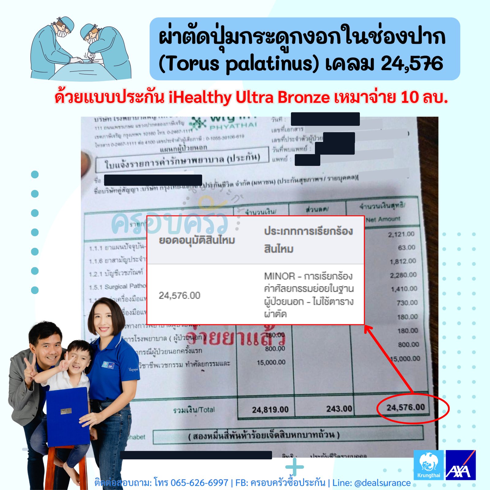 รูปรีวิวเคลม ปุ่มกระดูกงอกในช่องปาก (Torus palatinus) ต้องผ่าตัดออก (ปิดชื่อลูกค้าแล้ว)