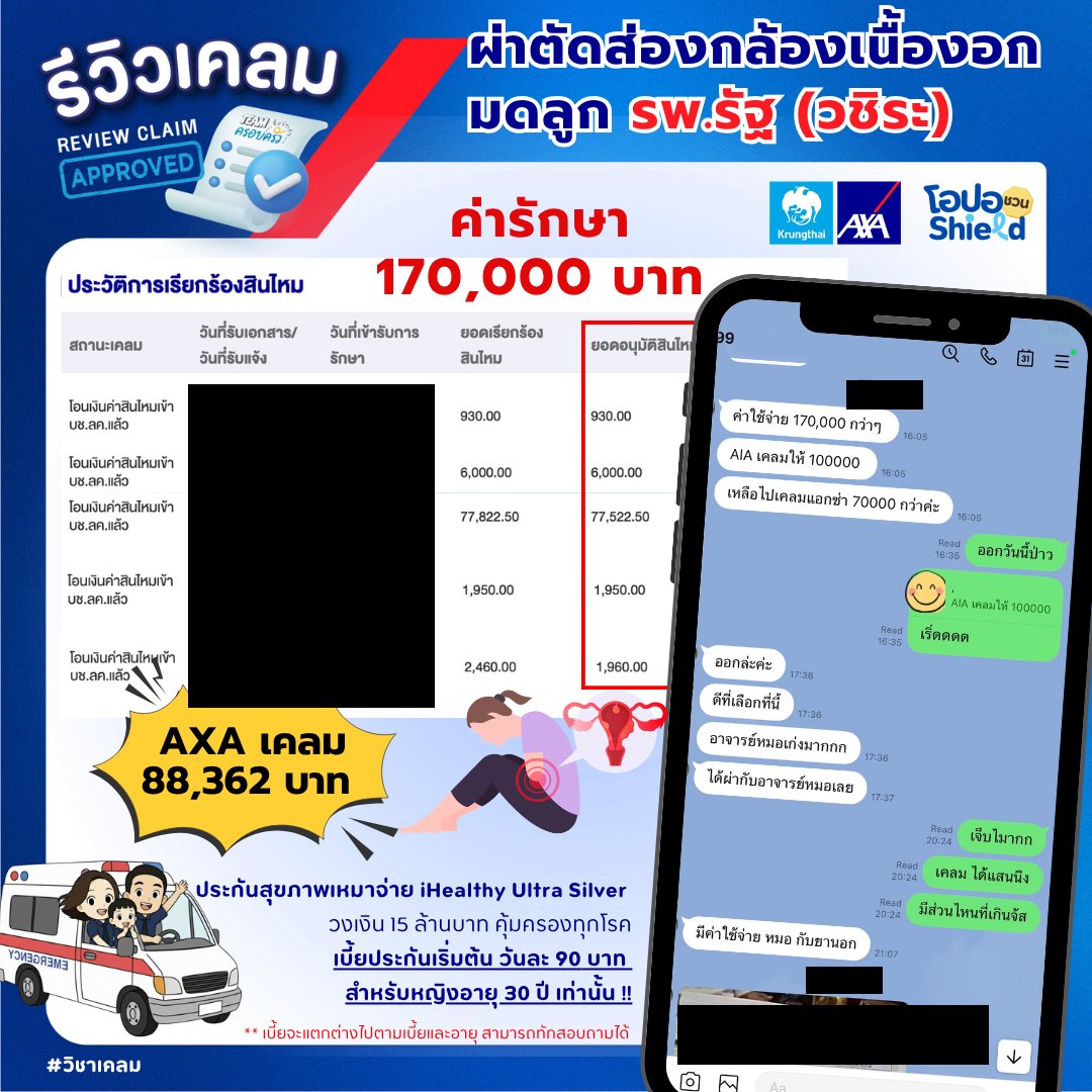รูปรีวิวเคลม เนื้องอกมดลูก ผ่าตัดส่องกล้องที่โรงพยาบาลรัฐอีกแห่ง ค่ารักษาก้อนเดียวแบ่งเคลมสองบริษัท (ปิดชื่อลูกค้าแล้ว)