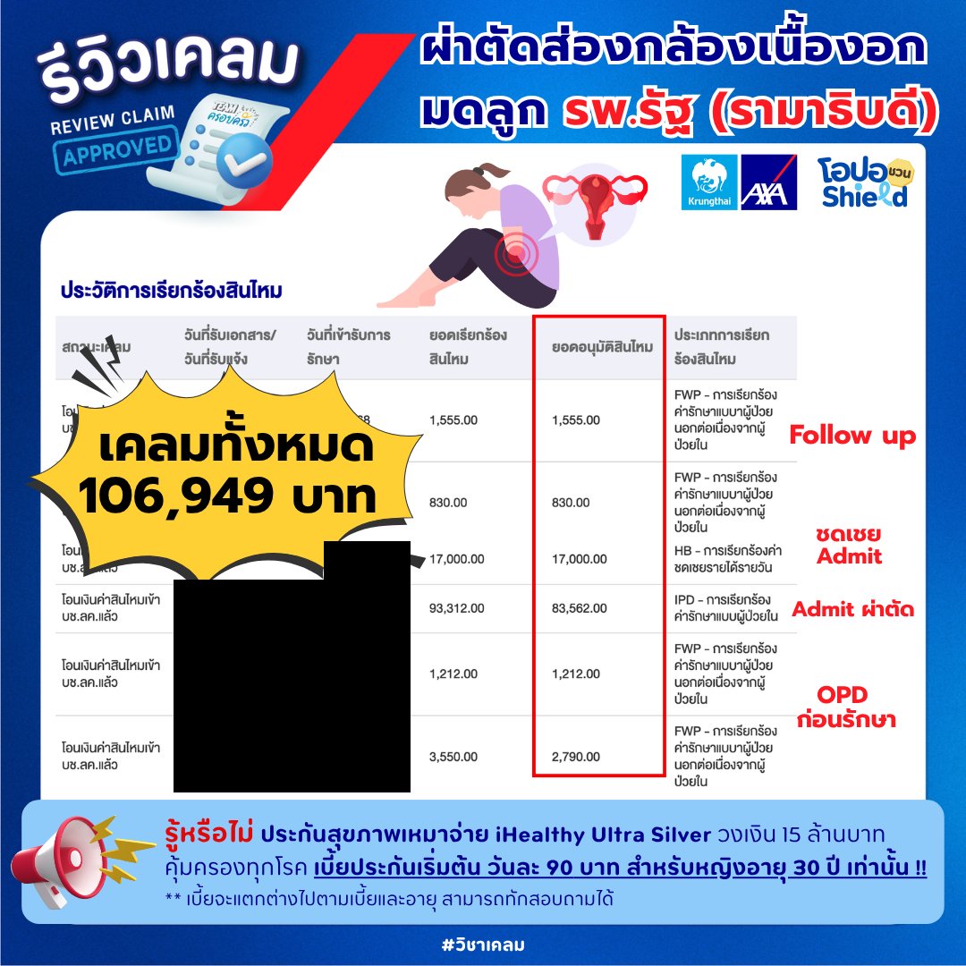 รูปรีวิวเคลม เนื้องอกมดลูก ผ่าตัดส่องกล้องที่โรงพยาบาลรัฐ เคลมรวม 6 รายการ ทั้งผู้ป่วยใน เงินชดเชยรายวัน และผู้ป่วยนอกก่อน/หลังผ่าตัด (ปิดชื่อลูกค้าแล้ว)